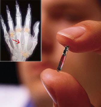 rfid chip news 2014|chip implanted in the hand.